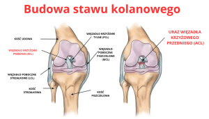 Rekonstrukcja więzadła krzyżowego przedniego ACL