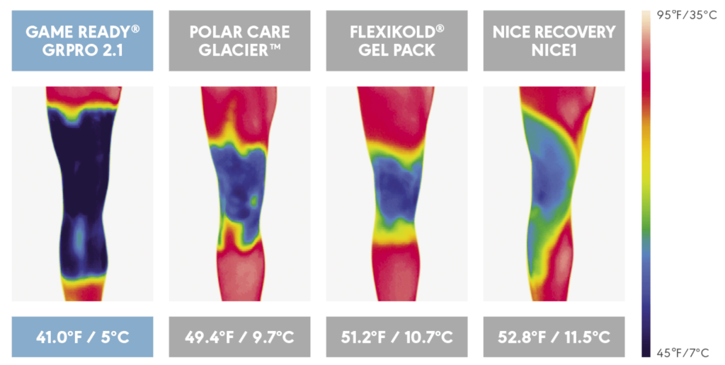 Porównanie skuteczności chłodzenia różnych urządzeń krioterapeutycznych: Game Ready GRPro 2.1, Polar Care Glacier, Flexikold Gel Pack, oraz Nice Recovery NICE1, przedstawione na termograficznym obrazie nóg. Game Ready GRPro 2.1 osiąga najniższą temperaturę chłodzenia - 41°F (5°C), co wskazuje na największą skuteczność terapii.