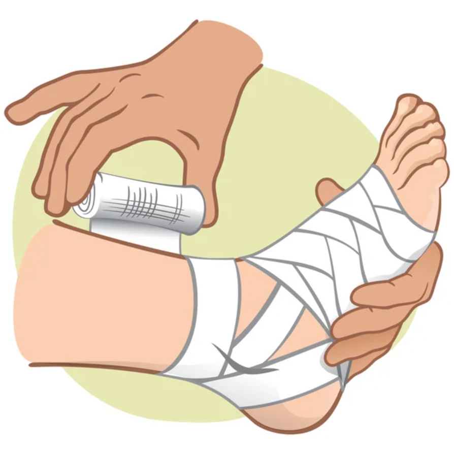 Domowe sposoby na skręconą kostkę: osoba z bandażem stosująca zimne okłady i podnosząca nogę.