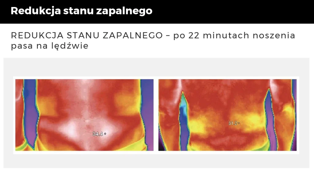 Badanie termograficzne – redukcja stanu zapalnego dzięki Incrediwear” Tytuł: „Incrediwear – redukcja stanu zapalnego
